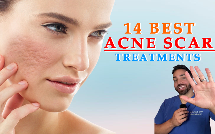 The 14 Best Acne Scar Treatments for Smooth, Even Skin, According to Dermatologists