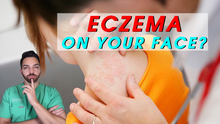 Eczema on Your Face? Dermatologists Give Their Best Tips for Managing It