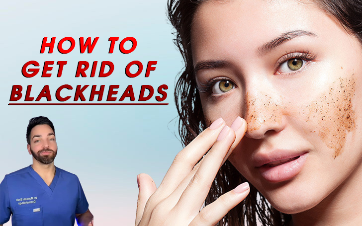 How to Get Rid of Blackheads, According to Dermatologists