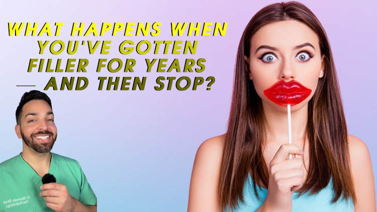 What Happens When You’ve Gotten Filler for Years — and Then Stop?