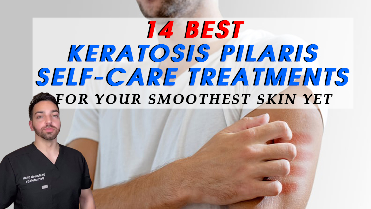 14 Best Keratosis Pilaris Self-Care Treatments for Your Smoothest Skin Yet