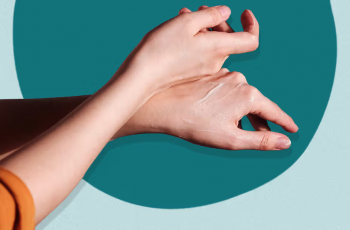 Salicylic Acid for Psoriasis: Benefits, Risks, and Treatment Tips